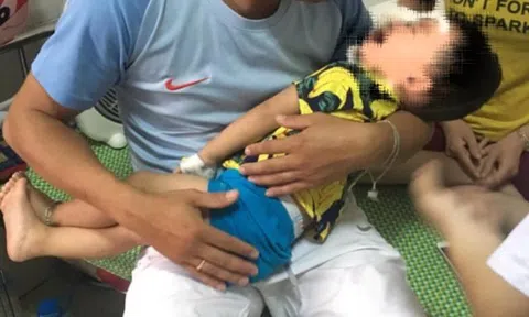 Thêm 1 trường hợp bé 2 tuổi bị chó nhà nuôi tấn công, cắn rách mặt, suýt hỏng mắt